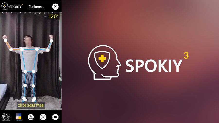 Гоніометр Spokiy